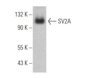 SV2A Antibody (E-8) - Western Blotting - Image 373415Each CRISPR/Cas9 Knockout (KO) Plasmid product consists of a pool of 3 plasmids designed to ensure identification and cleavage of a specific gene for maximum knockout efficiency. Each plasmid encodes a unique 20 nt sequence derived from the GeCKO (v2) library.