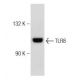 SW480 Cell Lysate: sc-2219. Western blot analysis of TLR8 expression...