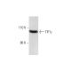SW480 Cell Lysate: sc-2219. Western blot analysis of TIF1 gamma expression... 