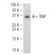 SW480 nuclear extract: sc-2155. Western blot analysis of TGIF expression...