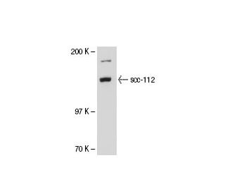 SW480 nuclear extract: sc-2155. Western blot analysis of scc-112 expression... 