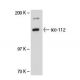 SW480 nuclear extract: sc-2155. Western blot analysis of scc-112 expression... 