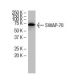 SWAP-70 Antibody (Q-28) - Western Blotting - Image 33644 