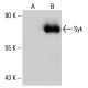 Syk Antibody (6A464) - Western Blotting - Image 20086 