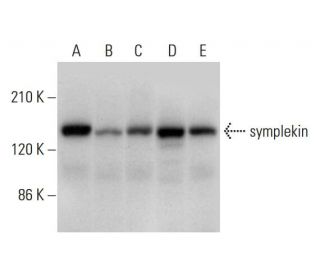 symplekin Antibody (G-6) - Western Blotting - Image 309756 