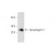 Synaptogyrin-1 Antibody (F-4) - Western Blotting - Image 60158