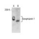 Synaptojanin 1 Antibody (AC1) - Western Blotting - Image 285952 
