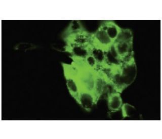 Synaptotagmin IV Antibody (28-N) - Immunofluorescence - Image 35885 