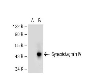 Synaptotagmin IV Antibody (28-N) - Western Blotting - Image 50592