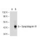 Synaptotagmin IV Antibody (28-N) - Western Blotting - Image 50592