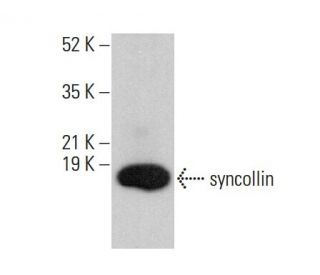 syncollin Antibody (D-11) - Western Blotting - Image 377408 