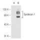 CD138/SDC1/Syndecan-1 Antibody (B-A38) - Western Blotting - Image 82555