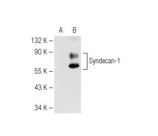 CD138/SDC1/Syndecan-1 Antibody (SB55a) - Western Blotting - Image 82553