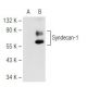 CD138/SDC1/Syndecan-1 Antibody (SB55a) - Western Blotting - Image 82553