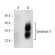 CD362/SDC2/Syndecan-2 Antibody (C-6) - Western Blotting - Image 148756