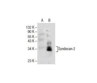 CD362/SDC2/Syndecan-2 Antibody (F-11) - Western Blotting - Image 154825