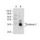 CD362/SDC2/Syndecan-2 Antibody (F-11) - Western Blotting - Image 154825