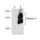 CD362/SDC2/Syndecan-2 Antibody (F-5) - Western Blotting - Image 154113