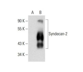 CD362/SDC2/Syndecan-2 Antibody (H-7) - Western Blotting - Image 143397 