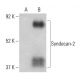 CD362/SDC2/Syndecan-2 Antibody (H-7) - Western Blotting - Image 398516 