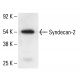 CD362/SDC2/Syndecan-2 Antibody (H-7) - Western Blotting - Image 411777