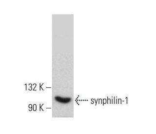 synphilin-1 Antibody (F-9) - Western Blotting - Image 383299 