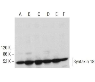 Syntaxin 18 Antibody (10) - Western Blotting - Image 380370 