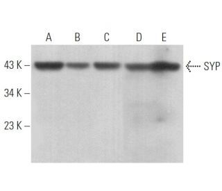 SYP/Synaptophysin Antibody (SY38) - Western Blotting - Image 375046 