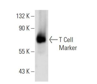 T Cell Marker Antibody (KEN-5) - Western Blotting - Image 17767