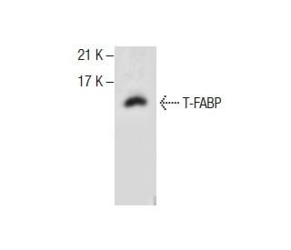 T-FABP Antibody (B-4) - Western Blotting - Image 287593Each CRISPR/Cas9 Knockout (KO) Plasmid product consists of a pool of 3 plasmids designed to ensure identification and cleavage of a specific gene for maximum knockout efficiency. Each plasmid encodes a unique 20 nt sequence derived from the GeCKO (v2) library.