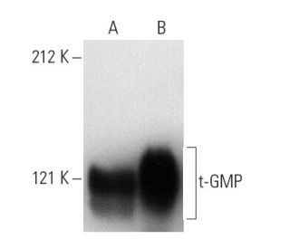 t-GMP Antibody (48A10) - Western Blotting - Image 4034