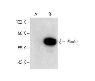 T-Plastin Antibody (A-8) - Western Blotting - Image 70311 
