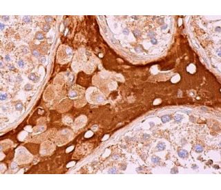 T-type Ca<sup>++</sup> CP &alpha;1H Antibody (G-10) - Immunohistochemistry - Image 369551 