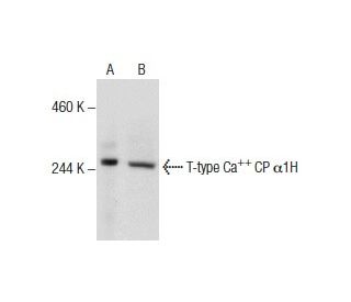 T-type Ca<sup>++</sup> CP &alpha;1H Antibody (G-10) - Western Blotting - Image 157480Each CRISPR/Cas9 Knockout (KO) Plasmid product consists of a pool of 3 plasmids designed to ensure identification and cleavage of a specific gene for maximum knockout efficiency. Each plasmid encodes a unique 20 nt sequence derived from the GeCKO (v2) library. 