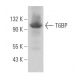 T6BP Antibody (H-6) - Western Blotting - Image 365985