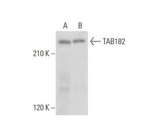 TAB182 Antibody (G-5) - Western Blotting - Image 319394