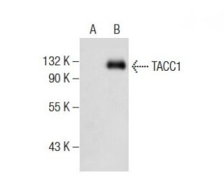 TACC1 Antibody (E-3) - Western Blotting - Image 283877
