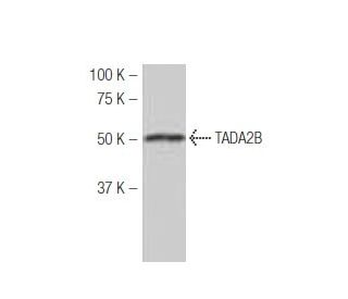 TADA2B Antibody (MB-56) - Western Blotting - Image 53979Each CRISPR/Cas9 Knockout (KO) Plasmid product consists of a pool of 3 plasmids designed to ensure identification and cleavage of a specific gene for maximum knockout efficiency. Each plasmid encodes a unique 20 nt sequence derived from the GeCKO (v2) library.