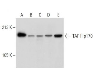 TAF II p170 Antibody (BTA3D61) - Western Blotting - Image 297448 