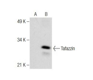 Tafazzin Antibody (E-3) - Western Blotting - Image 284498 