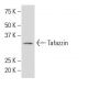 Tafazzin Antibody (JK-2) - Western Blotting - Image 34244 