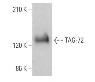 TAG-72 Antibody (0.N.561A) - Western Blotting - Image 363188 