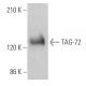 TAG-72 Antibody (0.N.561A) - Western Blotting - Image 363188 