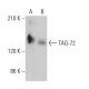 TAG-72 Antibody (0.N.561A) - Western Blotting - Image 381911