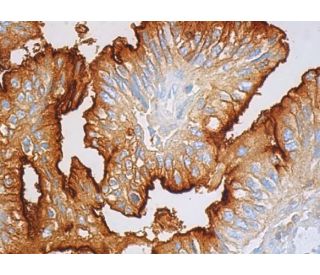 TAG-72 Antibody (B72.3) - Immunohistochemistry - Image 388734 