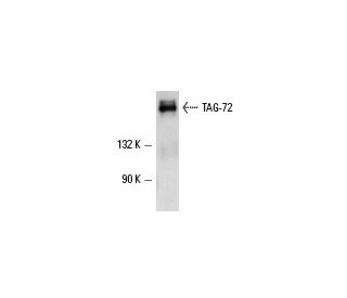 TAG-72 Antibody (CC49) - Western Blotting - Image 3707 