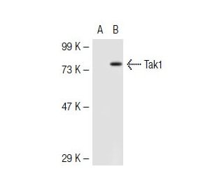 Tak1 Antibody (C-9) - Western Blotting - Image 43612