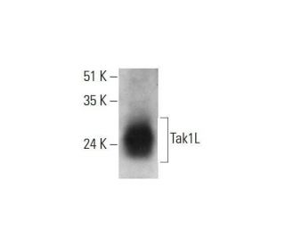 Tak1L Antibody (G-8) - Western Blotting - Image 348614