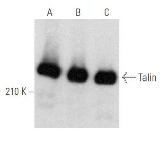 Talin Antibody (2Q1089) - Western Blotting - Image 354738 