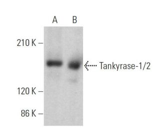 Tankyrase-1/2 Antibody (E-10) - Western Blotting - Image 359676